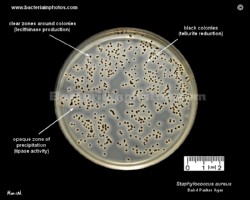 baird parker agar and staphylococcus aureus